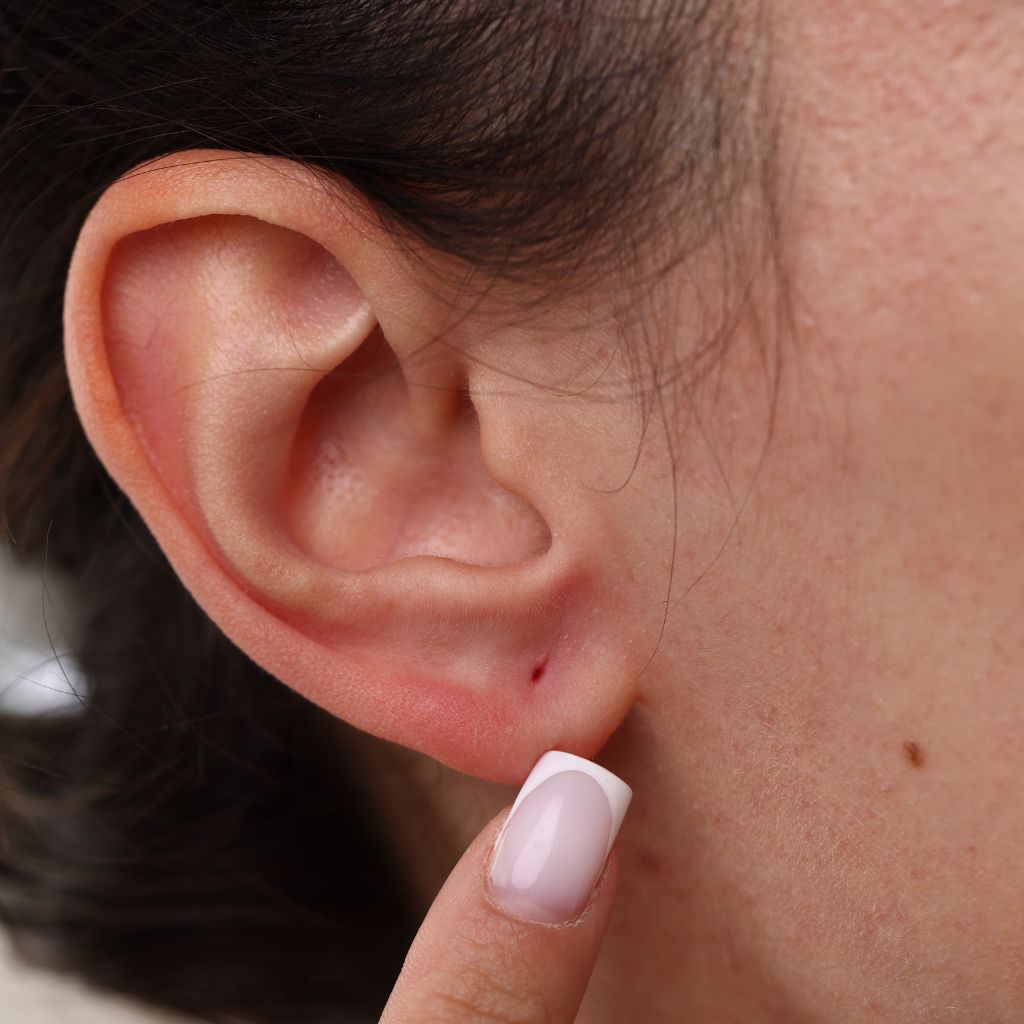 Otoplastia Valencia